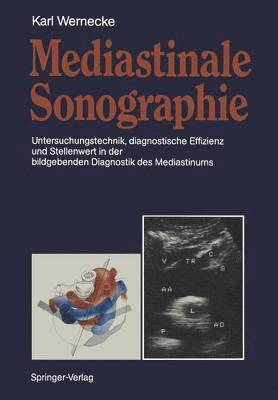 Mediastinale Sonographie 1