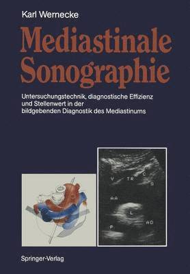 Karl Wernecke - Mediastinale Sonographie, Häftad