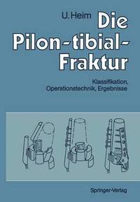 bokomslag Die Pilon-tibial-Fraktur