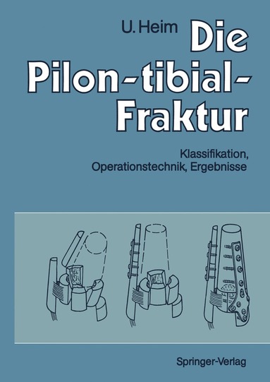 bokomslag Die Pilon-tibial-Fraktur