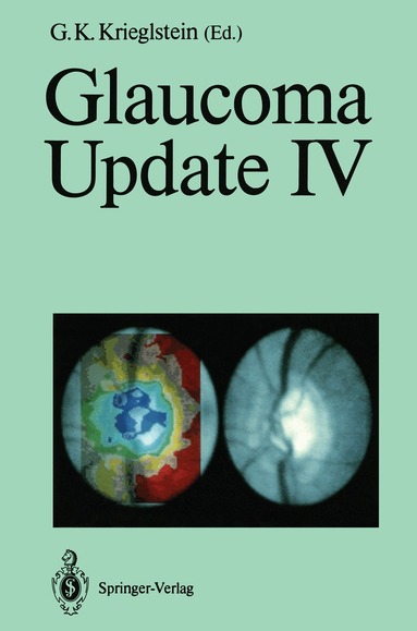 G.K. Krieglstein, G.K. Krieglstein - Glaucoma Update IV, Häftad