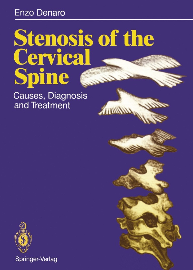 Vincenzo Denaro - Stenosis of the Cervical Spine, Häftad