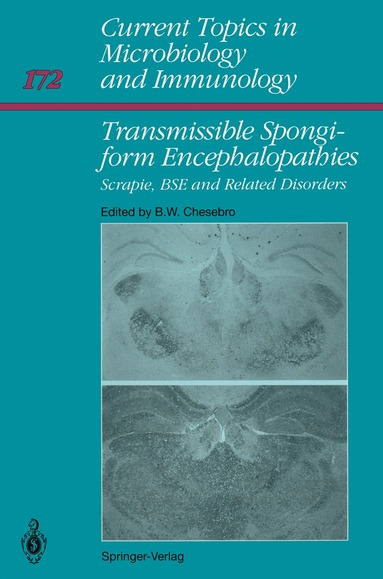 bokomslag Transmissible Spongiform Encephalopathies: