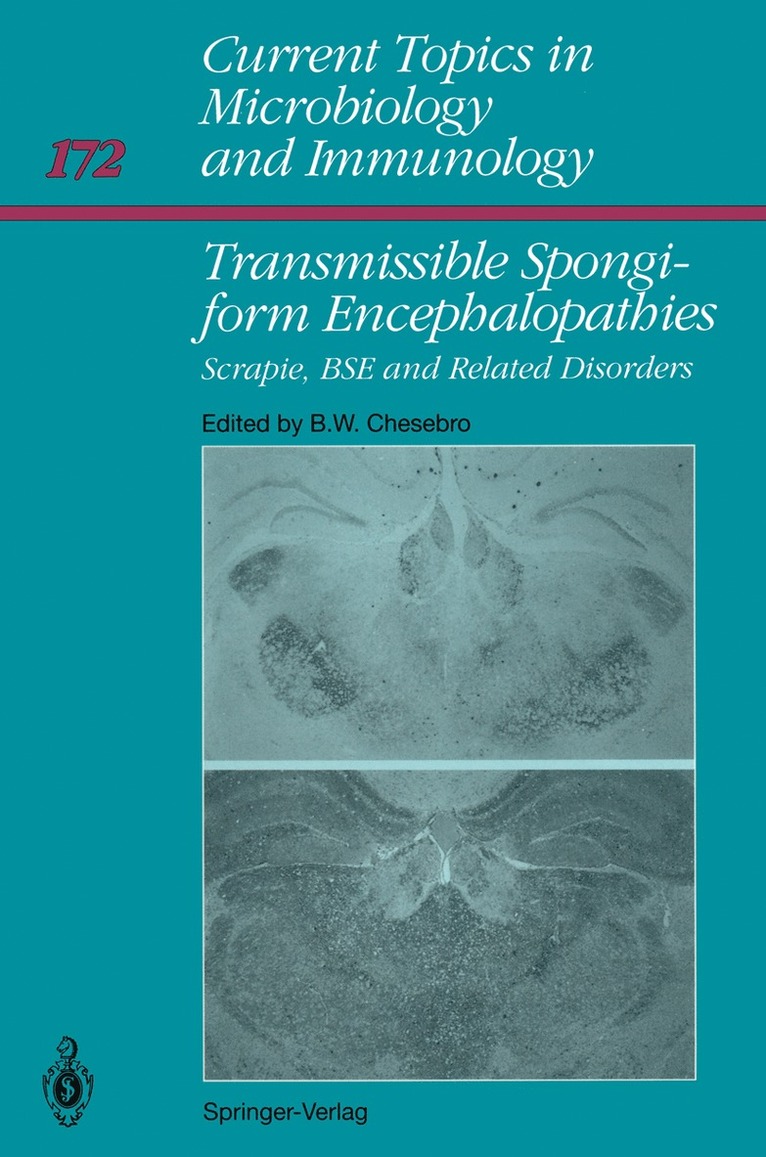 Bruce W. Chesebro - Transmissible Spongiform Encephalopathies:, Häftad