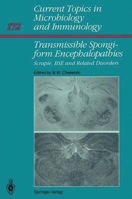 Transmissible Spongiform Encephalopathies: 1