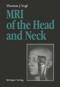bokomslag MRI of the Head and Neck