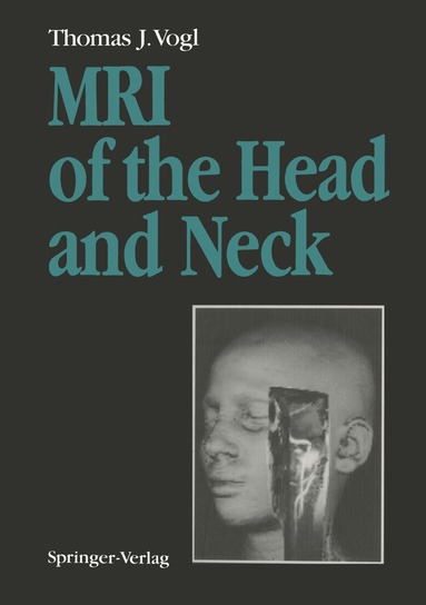 bokomslag MRI of the Head and Neck