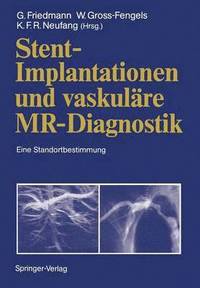 bokomslag Stent-Implantationen und vaskulre MR-Diagnostik
