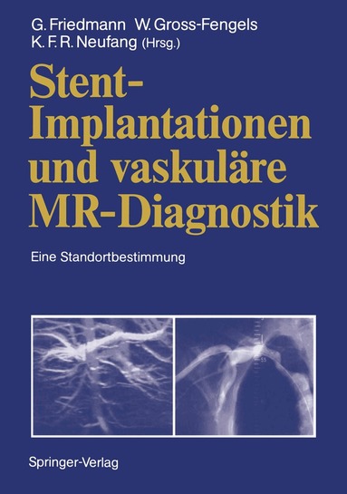 Gerd Friedmann, Walter Gross-Fengels, Karl F.R. Neufang - Stent-Implantationen und vaskuläre MR-Diagnostik, Häftad