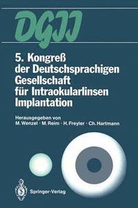 bokomslag 5. Kongre der Deutschsprachigen Gesellschaft fr Intraokularlinsen Implantation