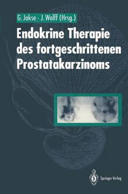 bokomslag Endokrine Therapie des fortgeschrittenen Prostatakarzinoms