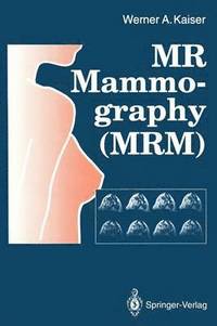 bokomslag MR Mammography (MRM)
