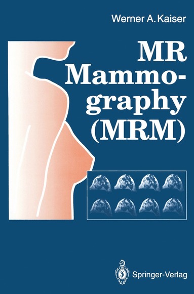 bokomslag MR Mammography (MRM)