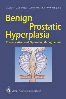 bokomslag Benign Prostatic Hyperplasia