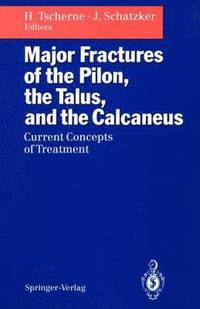 bokomslag Major Fractures of the Pilon, the Talus, and the Calcaneus