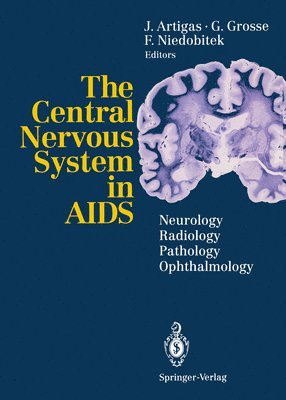 The Central Nervous System in AIDS 1