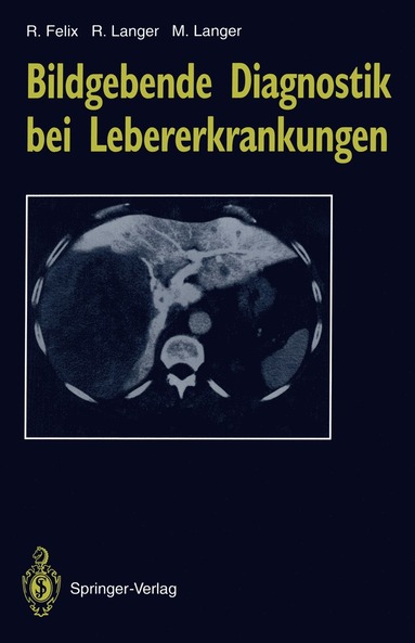 bokomslag Bildgebende Diagnostik bei Lebererkrankungen