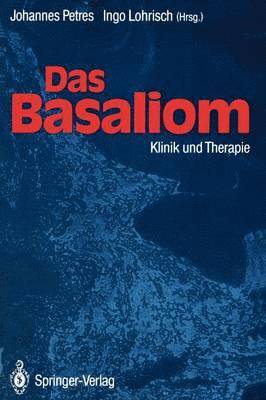 Johannes Petres, Ingo Lohrisch - Das Basaliom, Häftad