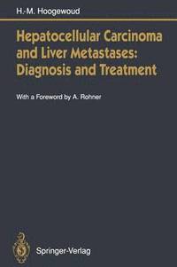 bokomslag Hepatocellular Carcinoma and Liver Metastases: Diagnosis and Treatment