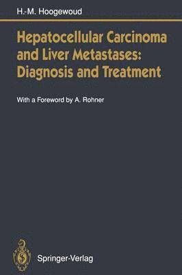 Hepatocellular Carcinoma and Liver Metastases: Diagnosis and Treatment 1