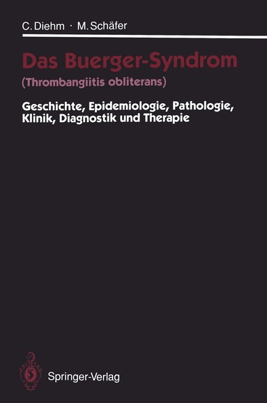 Curt Diehm, Michael Schäfer, Curt Diehm, Michael Schäfer - Das Buerger-Syndrom (Thrombangiitis obliterans), Häftad