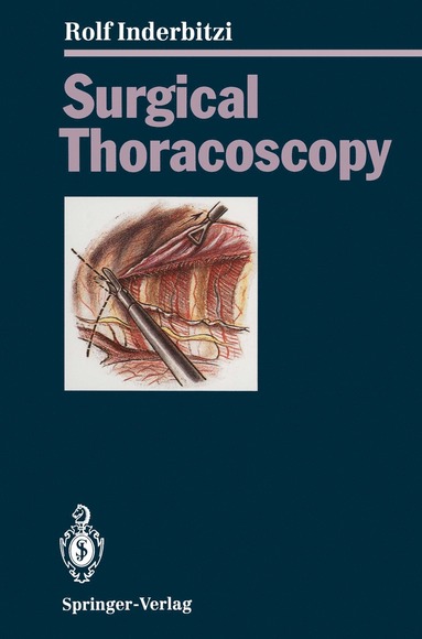 bokomslag Surgical Thoracoscopy