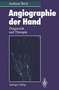 bokomslag Angiographie der Hand