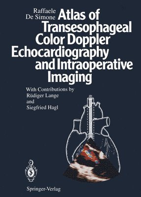 Atlas of Transesophageal Color Doppler Echocardiography and Intraoperative Imaging 1