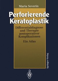 bokomslag Perforierende Keratoplastik