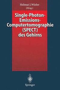 bokomslag Single-Photon-Emissions-Computertomographie (SPECT) des Gehirns