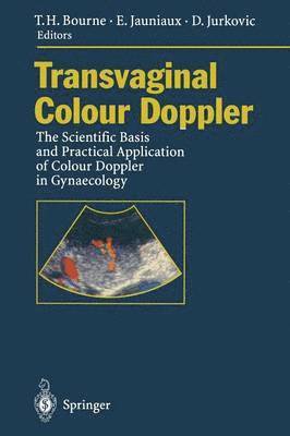 Transvaginal Colour Doppler 1