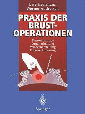 bokomslag Praxis der Brustoperationen