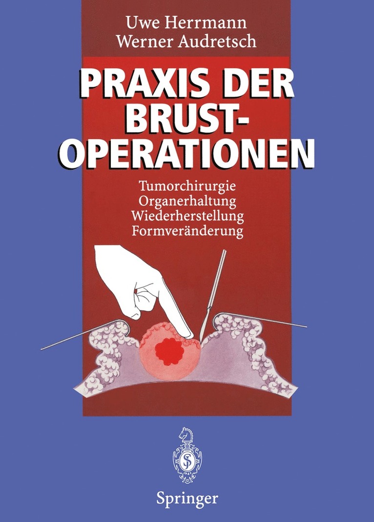 Uwe Herrmann, Werner Audretsch - Praxis der Brustoperationen, Häftad