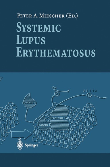 bokomslag Systemic Lupus Erythematosus