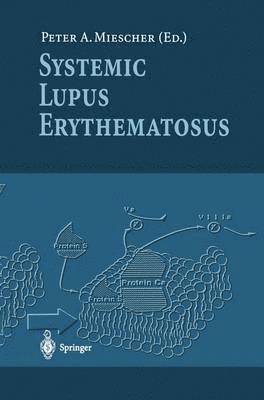 Systemic Lupus Erythematosus 1