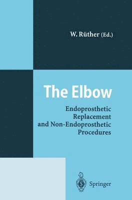 The Elbow 1