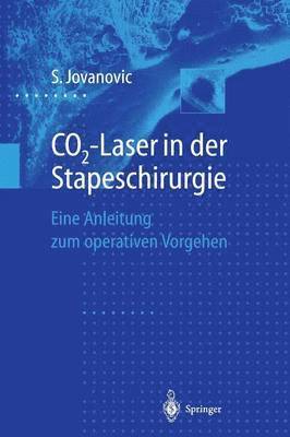 CO2-Laser in der Stapeschirurgie 1