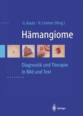 Hmangiome 1