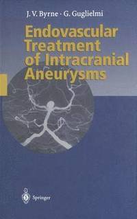 bokomslag Endovascular Treatment of Intracranial Aneurysms