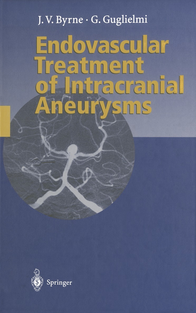 James Byrne, Guido Guglielmi - Endovascular Treatment of Intracranial Aneurysms, Häftad