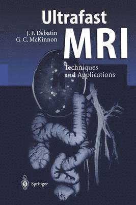 Jörg F. Debatin, Graeme C. McKinnon, Jorg F. Debatin - Ultrafast MRI, Häftad