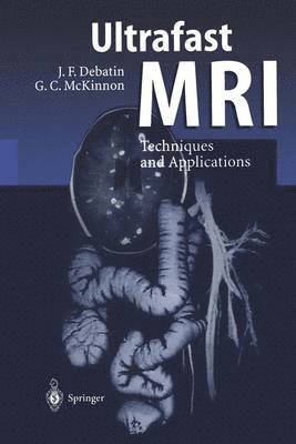 Ultrafast MRI 1