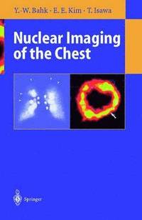 bokomslag Nuclear Imaging of the Chest