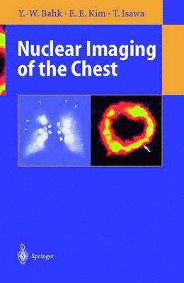 bokomslag Nuclear Imaging of the Chest