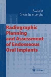 bokomslag Radiographic Planning and Assessment of Endosseous Oral Implants