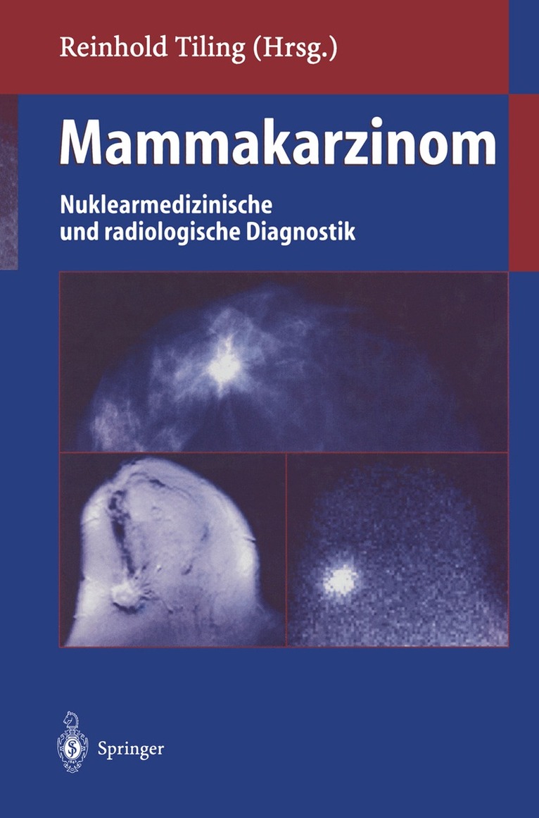 Reinhold Tiling - Mammakarzinom, Häftad