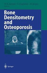 bokomslag Bone Densitometry and Osteoporosis