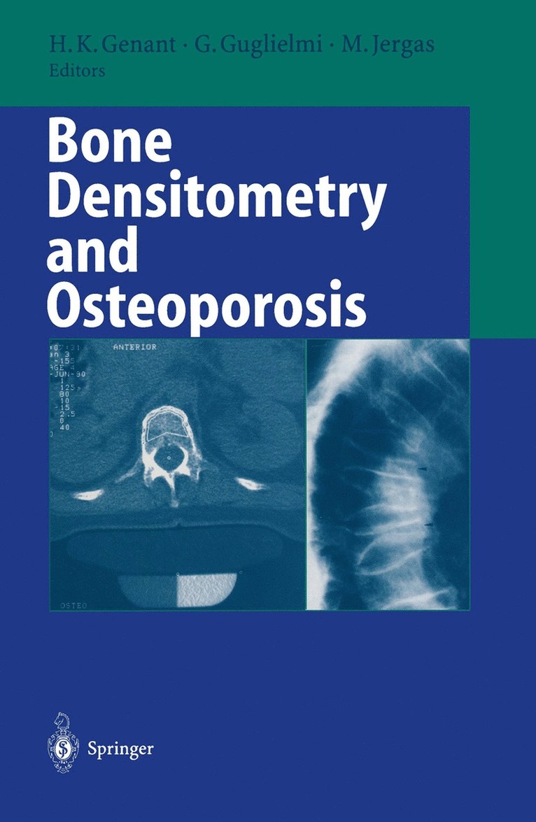 Harry K. Genant, Giuseppe Guglielmi, Michael Jergas - Bone Densitometry and Osteoporosis, Häftad