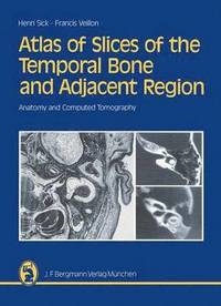 bokomslag Atlas of Slices of the Temporal Bone and Adjacent Region