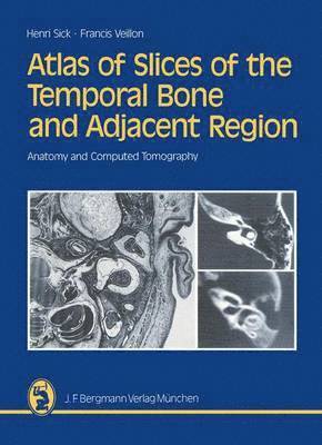 Atlas of Slices of the Temporal Bone and Adjacent Region 1